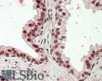 EB09833 1