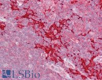 EB05454-T 2