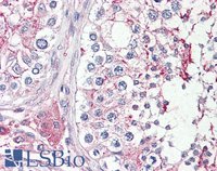 EB08341 1