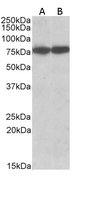 EB07295-T 1