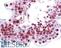 EB10954 1
