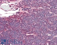 EB10995 4