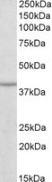 EB10998 1