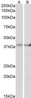 EB10998 2
