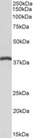 EB10998 3