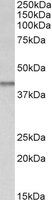EB10997 1