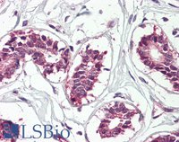 EB10067 2