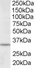 EB05452 1