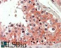 EB09511 1