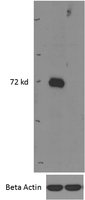 EB08674-T 2