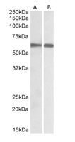 EB05585 1