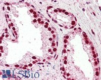 EB05404 4