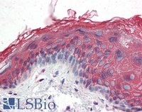 EB07063 2