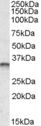 EB09406 1