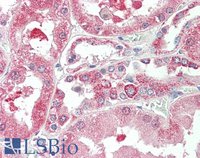 EB08880 2