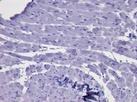 EB05401 2