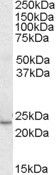 EB05466 1