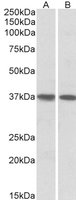 EB05475 1