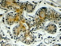 EB07011 1