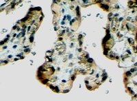 EB07011 2