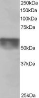 EB06238 1