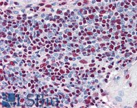 EB07209-T 2