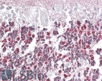 EB08570 1