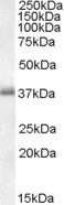 EB06418-T 1