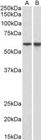 EB11387 3