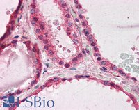 EB05439 3