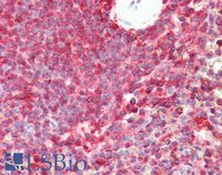 EB09445 2