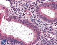 EB06521 3