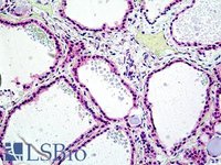 EB06560 4