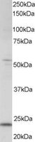 EB05652 1