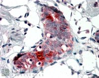 EB06810 1