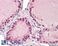 EB08105 1
