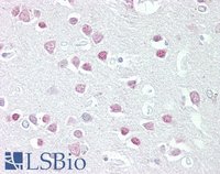 EB08447 2