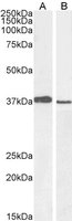 EB05955 1