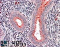 EB08139 1