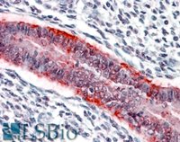 EB06891 2