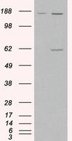 EB06928 2