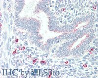 EB06330 2