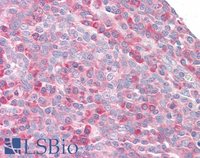 EB05619 2