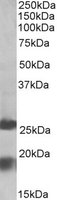 EB10432 1