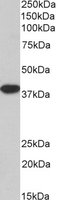 EB06079-B 1