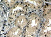 EB08699 2