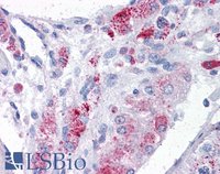 EB05163 2