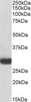EB06667-B 1