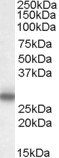 EB07944 1