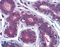 EB06023 2